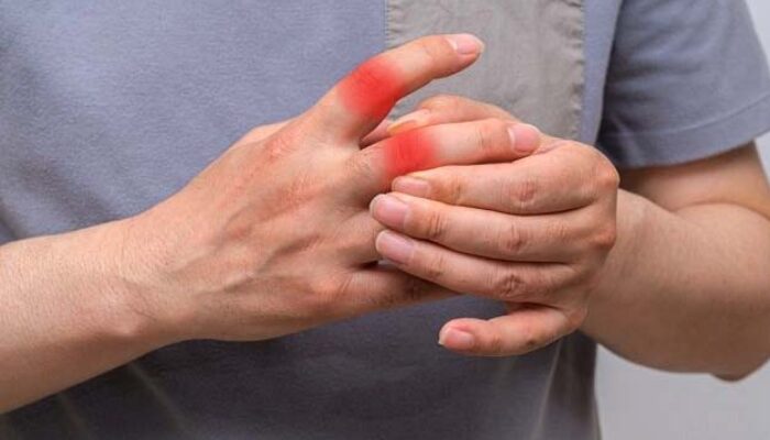 Asam Urat Kambuh Malam Hari, Ini Penyebab dan Solusinya